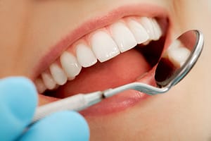 Dental checkups