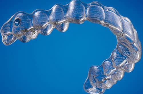 invisalign aligners