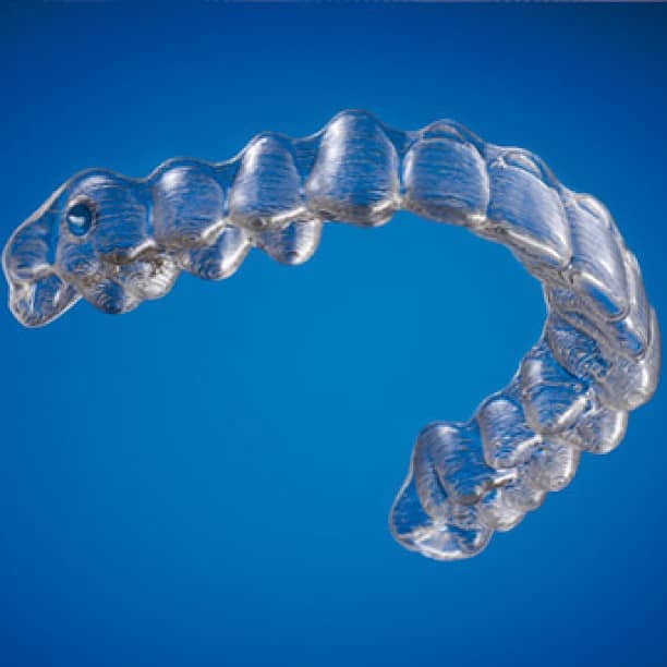 invisalign aligners