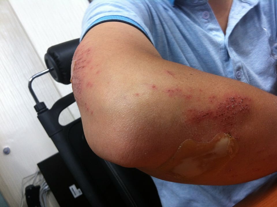 skin problem